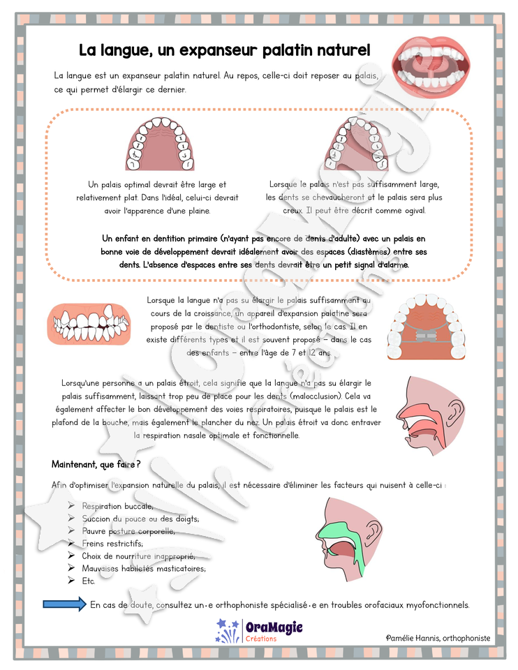 Capsule d'information - La langue, un expanseur palatin naturel Capsule d'information - La langue, un expanseur palatin naturel